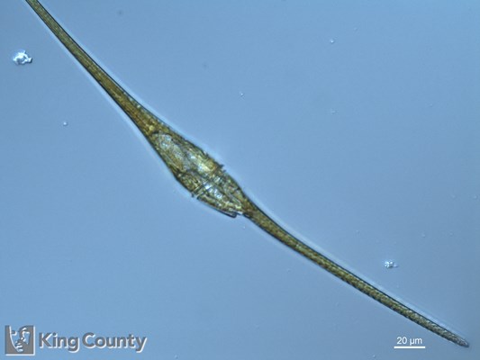 Photo of Ceratium fusus